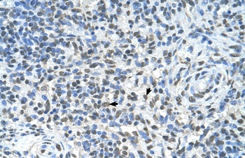 ZMYND11 Antibody