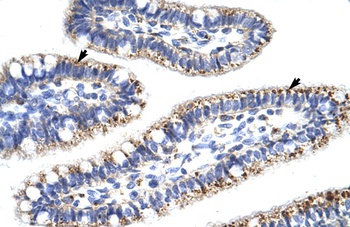 KLHL13 Antibody