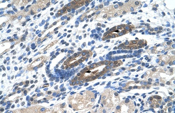 BTBD14A Antibody