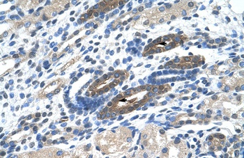 NACC2 Antibody