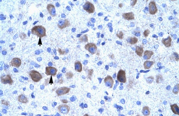 KCNIP4 Antibody