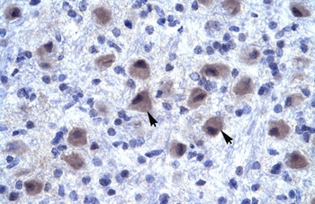 RNF141 Antibody