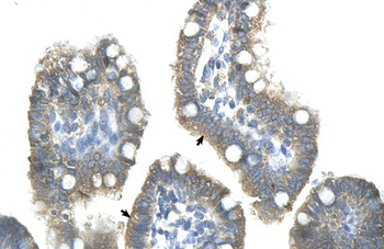 ZNF498 Antibody
