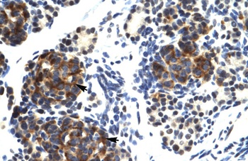 TRIM41 Antibody