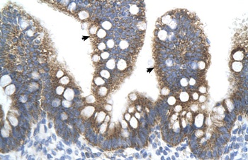 TFB2M Antibody