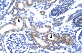 ZFAND6 Antibody