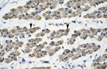 TRIM68 Antibody