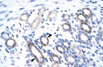 YBX2 Antibody