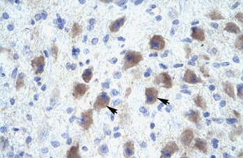 PAX9 Antibody