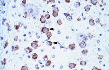CRSP6 Antibody