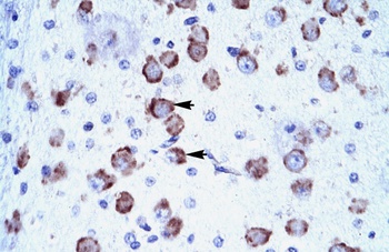 MED17 Antibody