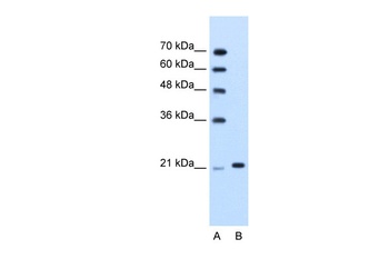 TRIM26 Antibody