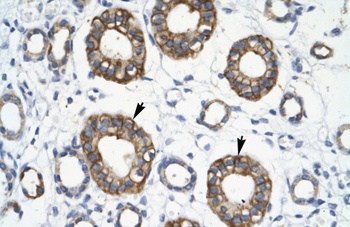 TRIM13 Antibody