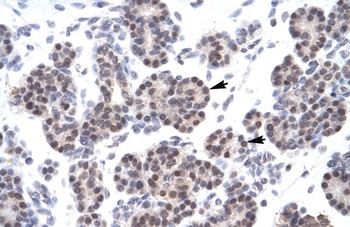 XRCC5 Antibody