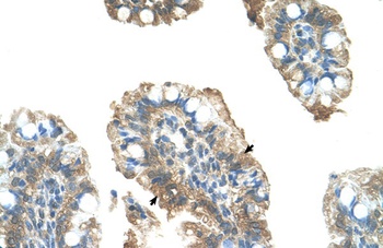 PARP6 Antibody