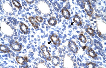 RGS6 Antibody