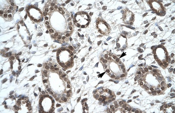 KIF25 Antibody