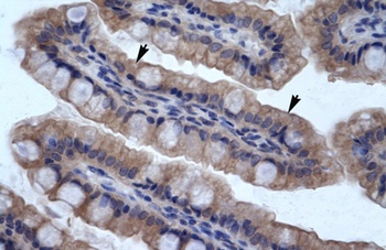 SMPDL3B Antibody