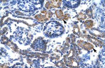 C4BPB Antibody