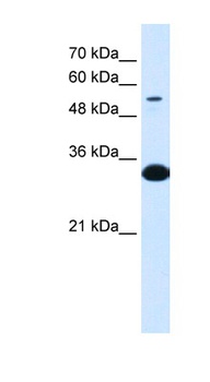 A1BG Antibody