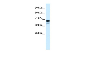 PARP6 Antibody
