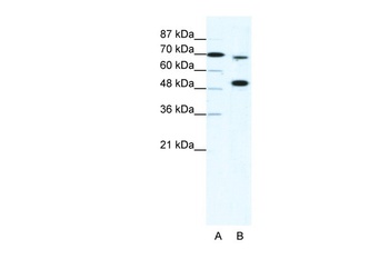 KMT2B Antibody