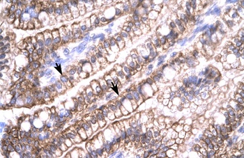 CLDN8 Antibody