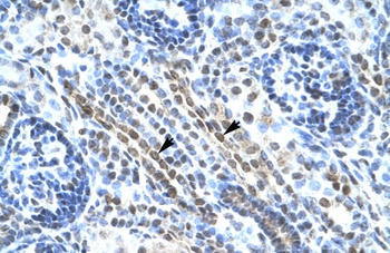 ANKRD11 Antibody