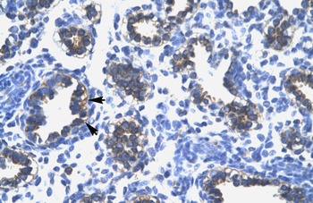 RPS16 Antibody