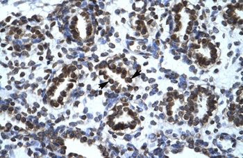 TGFB1I1 Antibody