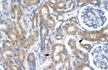 TFDP2 Antibody