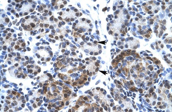 SUPT5H Antibody