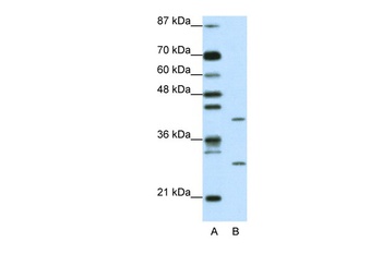 ZFP36L1 Antibody