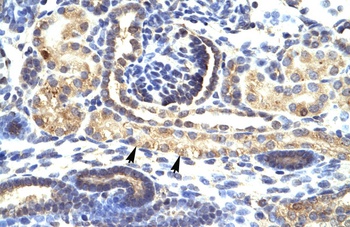 SNAI1 Antibody