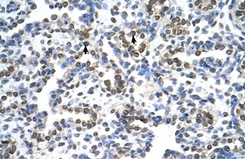 MRPS15 Antibody