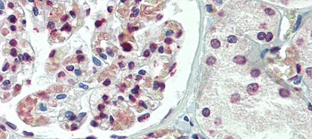 TBX20 Antibody