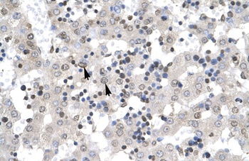 ZNF654 Antibody