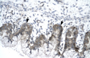 IVNS1ABP Antibody