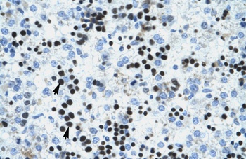 IVNS1ABP Antibody