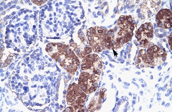 SOX18 Antibody