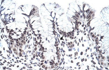 PHF1 Antibody