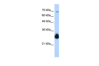 RNF138 Antibody