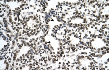 ZNF706 Antibody