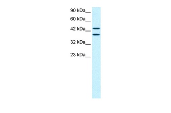 ZNF839 Antibody