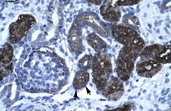 GPBP1 Antibody
