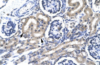 TRAFD1 Antibody