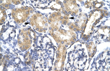 ACSL1 Antibody