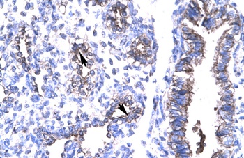 HTATIP2 Antibody