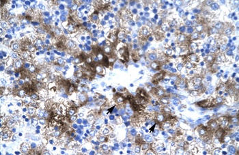 PIAS3 Antibody