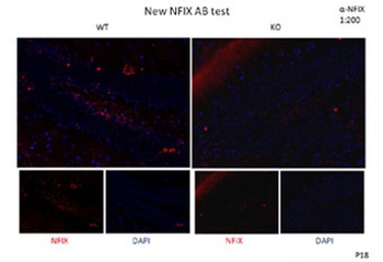 NFIX Antibody